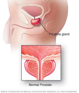 Adalah gangguan pada radang kesehatan berupa pada prostatitis pria reproduksi Sistem Reproduksi
